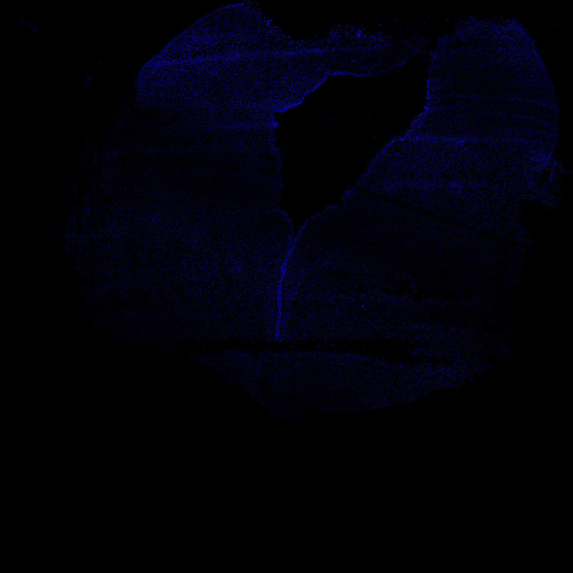 Human foetal midbrain